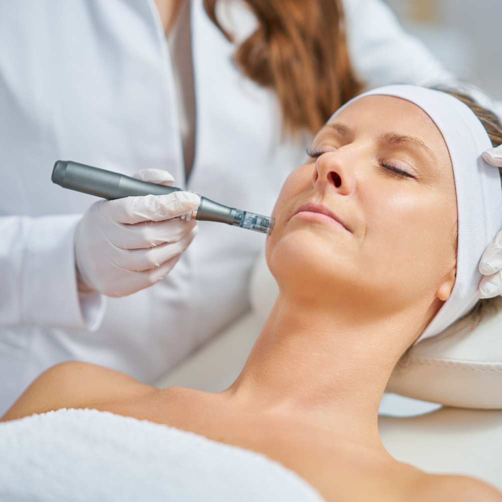 Ageless Microneedling